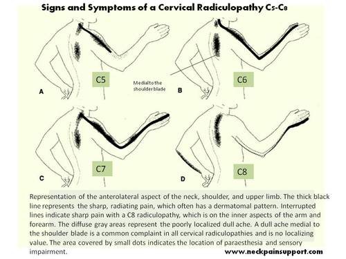 signs_and_symptoms_of_a_cervical__2